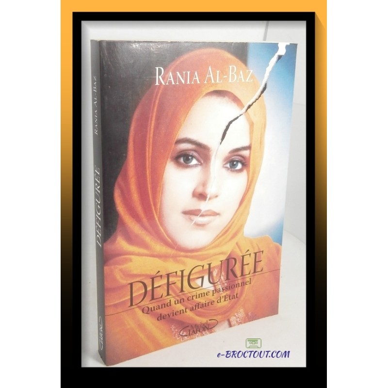 Rania AL-BAZ : Défigurée - Quand un crime passionnel devient affaire d'Etat